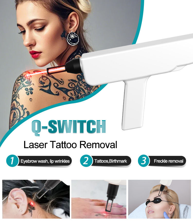 IPL+Q-Switch+Diode Laser (3 in 1)