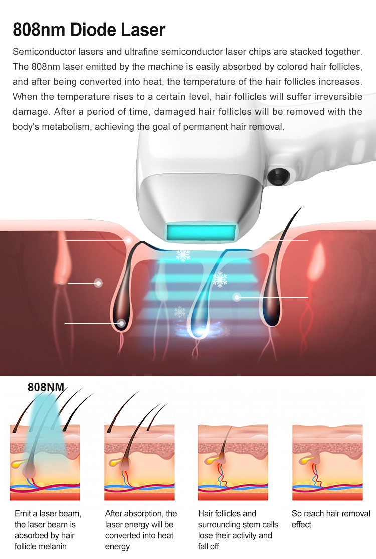 IPL+Q-Switch+Diode Laser (3 in 1)