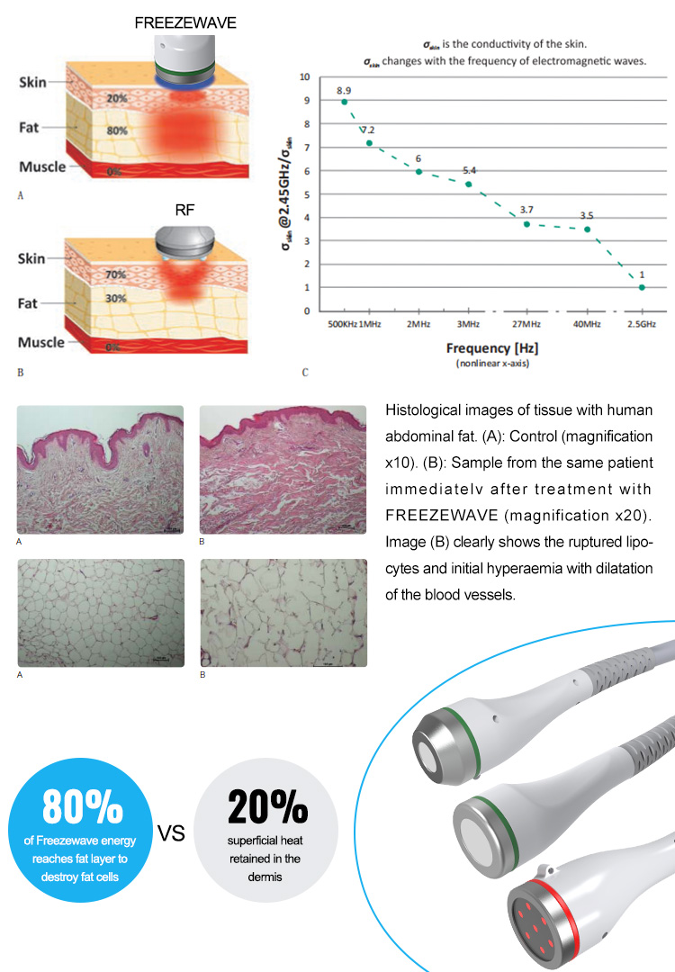 Coolwave Body Shape (DT-85)