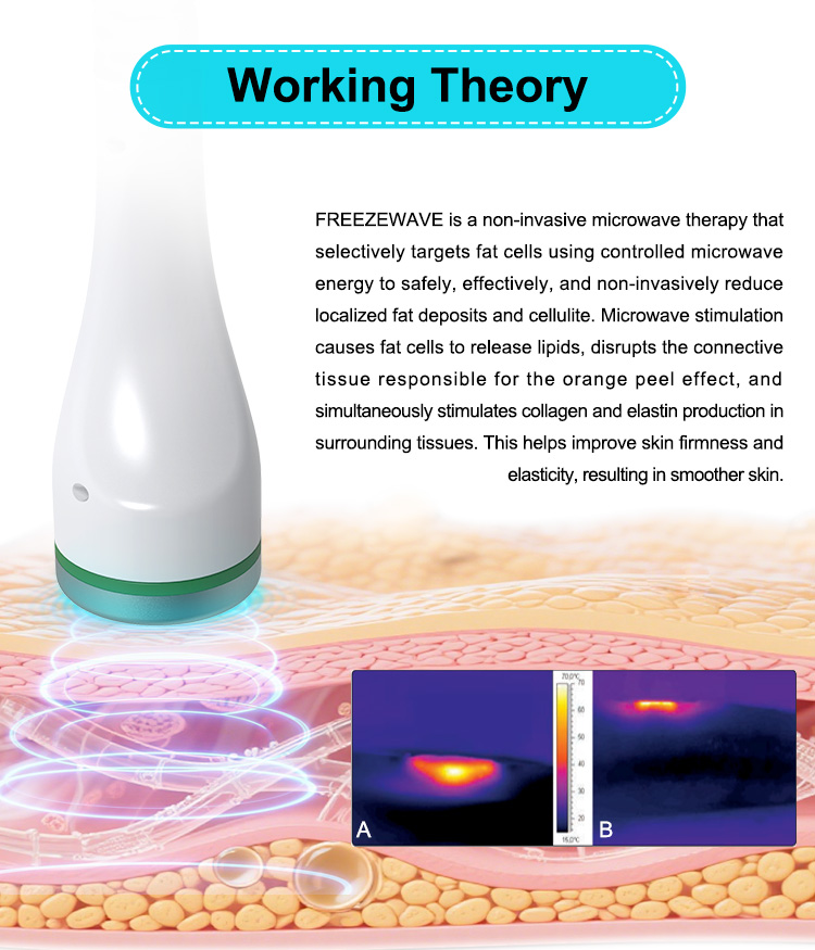Coolwave Body Shape (DT-86)