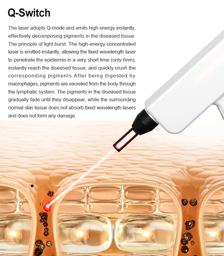 IPL+Q-Switch+Diode Laser (3 in 1)
