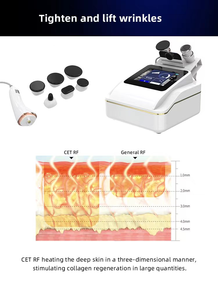Monopolar RF with CET & RET