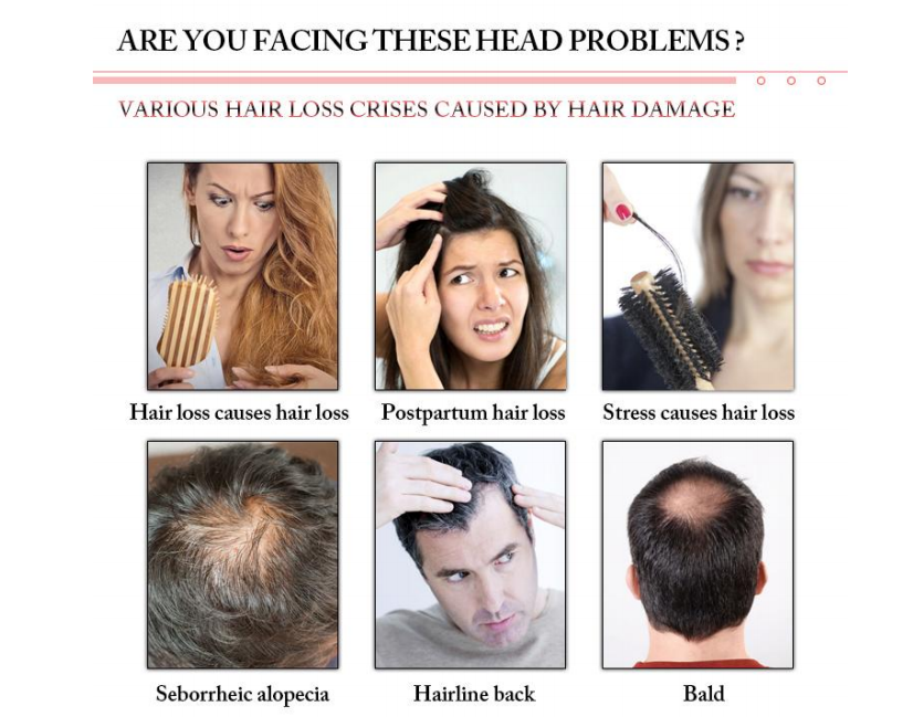 Laser Hair Regrowth device