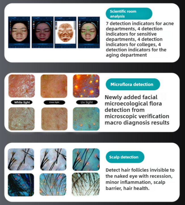 Skin Analyzer
