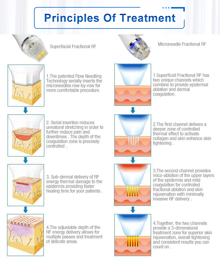 Mini Gold RF Microneedle 