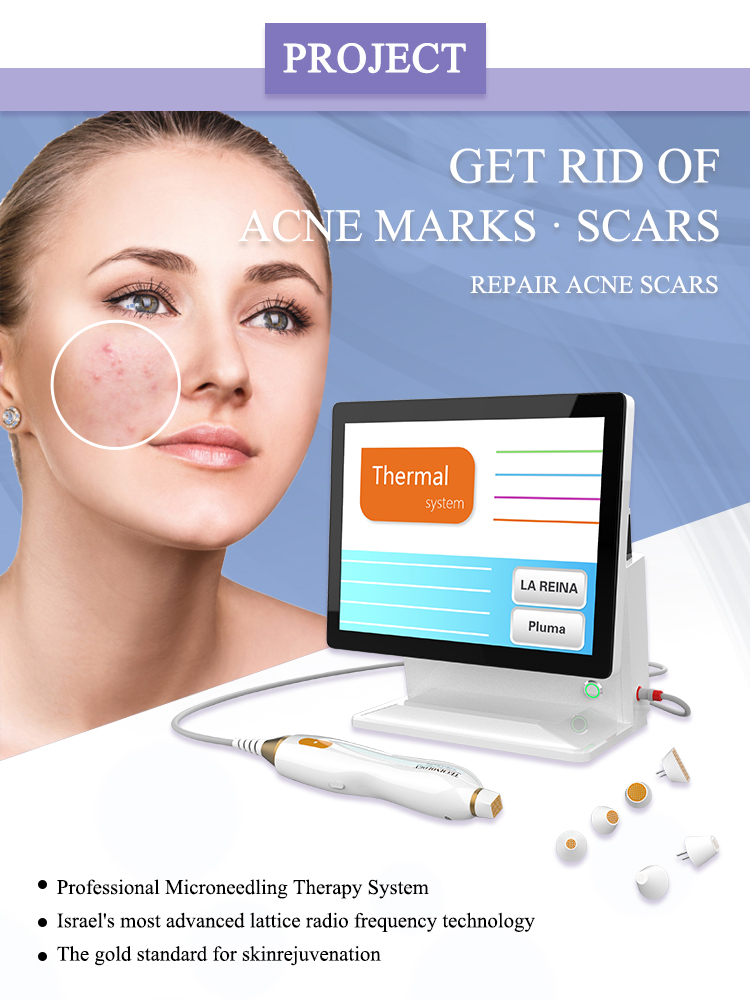 Gold RF Microneedle (DT-816)