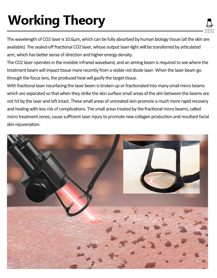 Fractional CO2 Laser