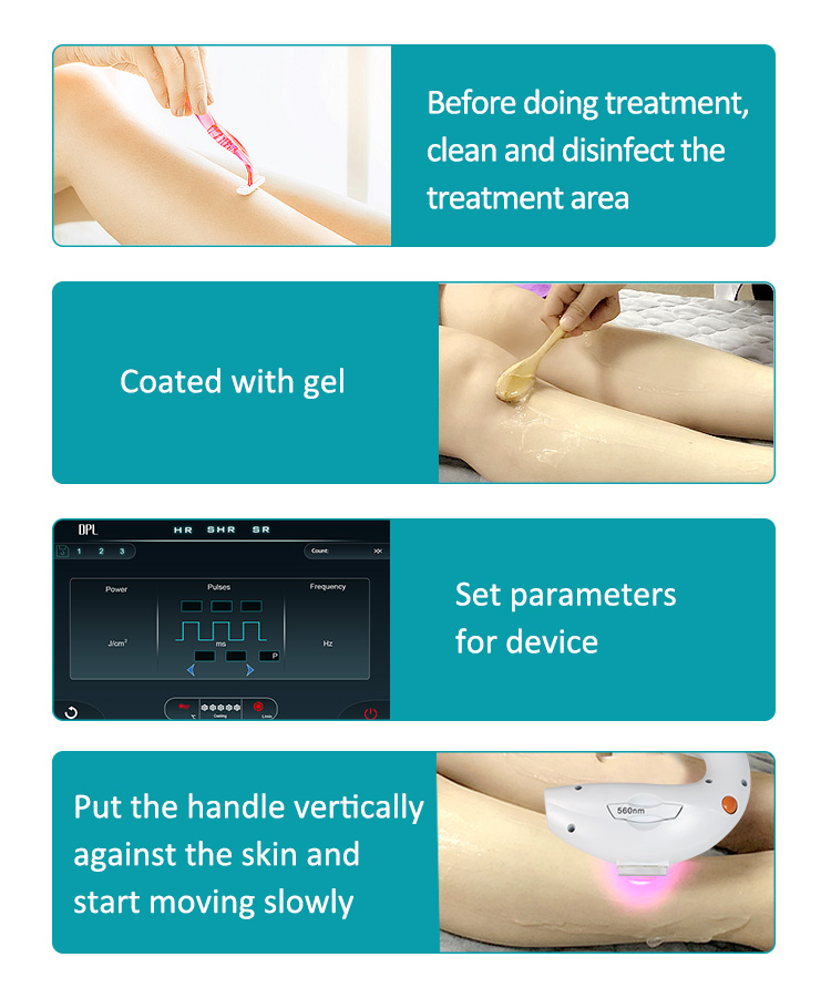 IPL+Q-Switch (2 in 1)