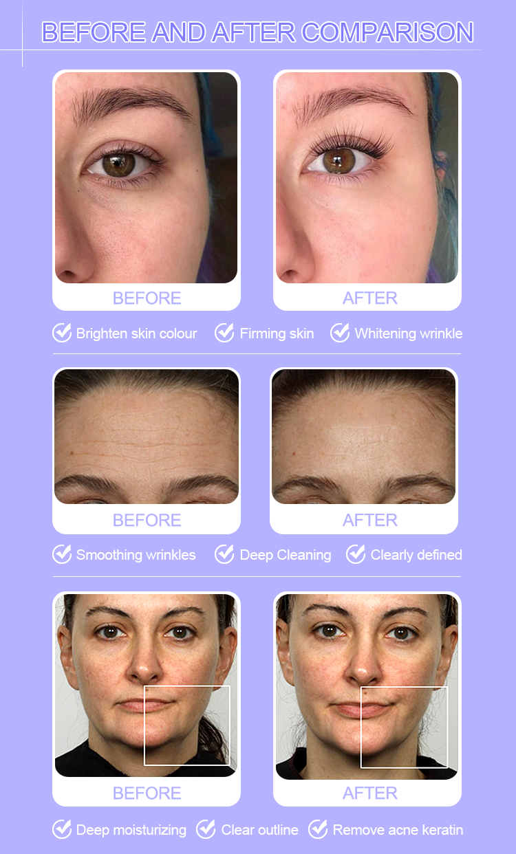 Hydro-Facial Skin Platform
