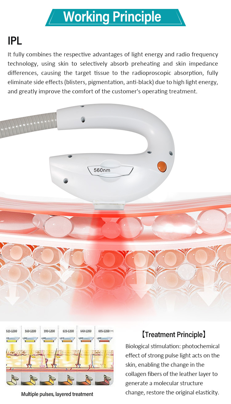IPL+Q-Switch (2 in 1)