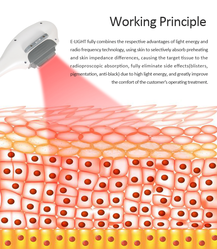 Portable IPL Elight+RF