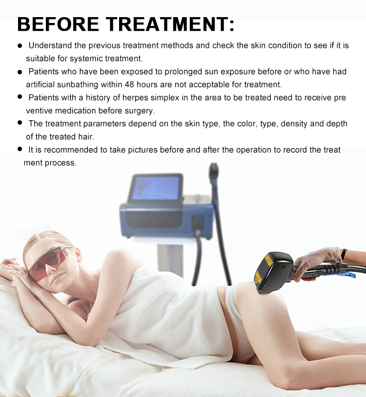 4 Wavelengths Diode laser