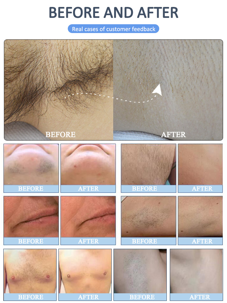 3 Wavelengths Diode laser