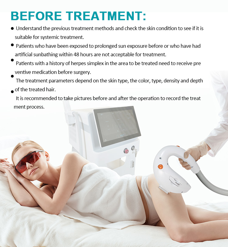 IPL+Q-Switch (2 in 1)