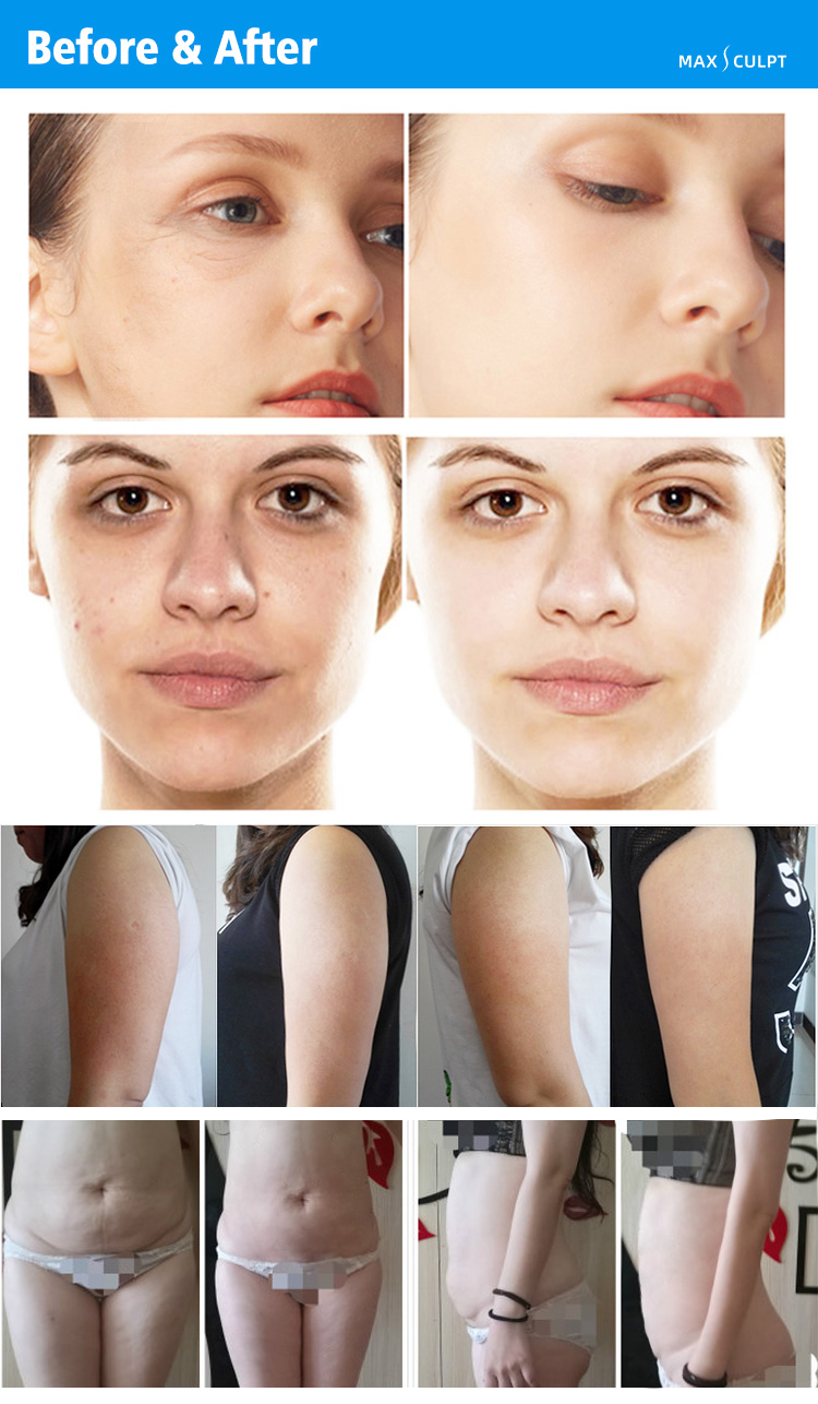 Body Shape Slimming (DT-V68)