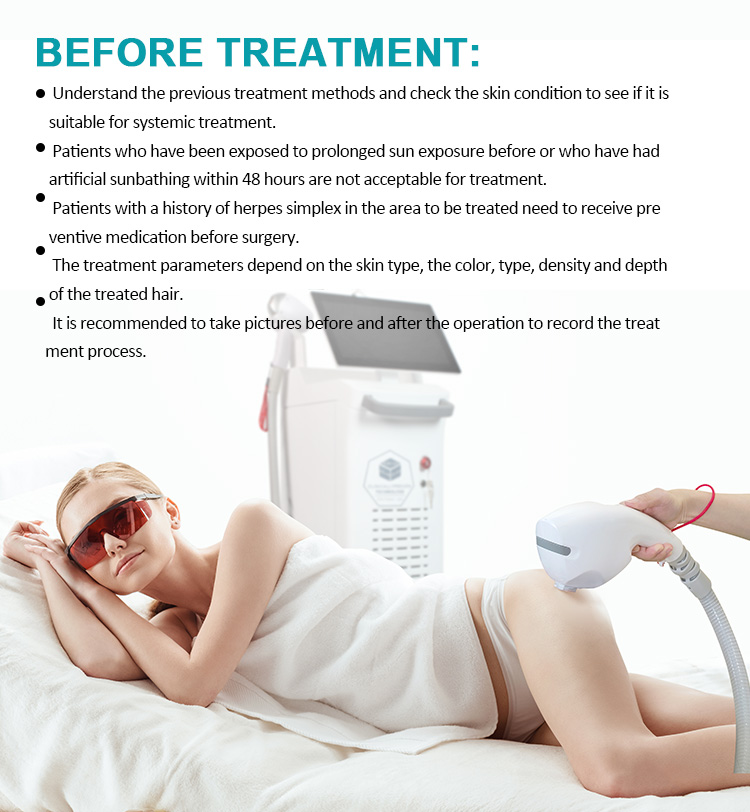 IPL+Q-Switch+Diode Laser (3 in 1)