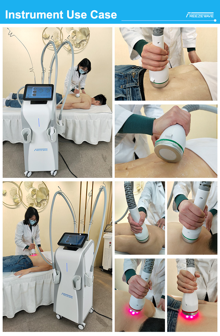 Coolwave Body Shape (DT-85)