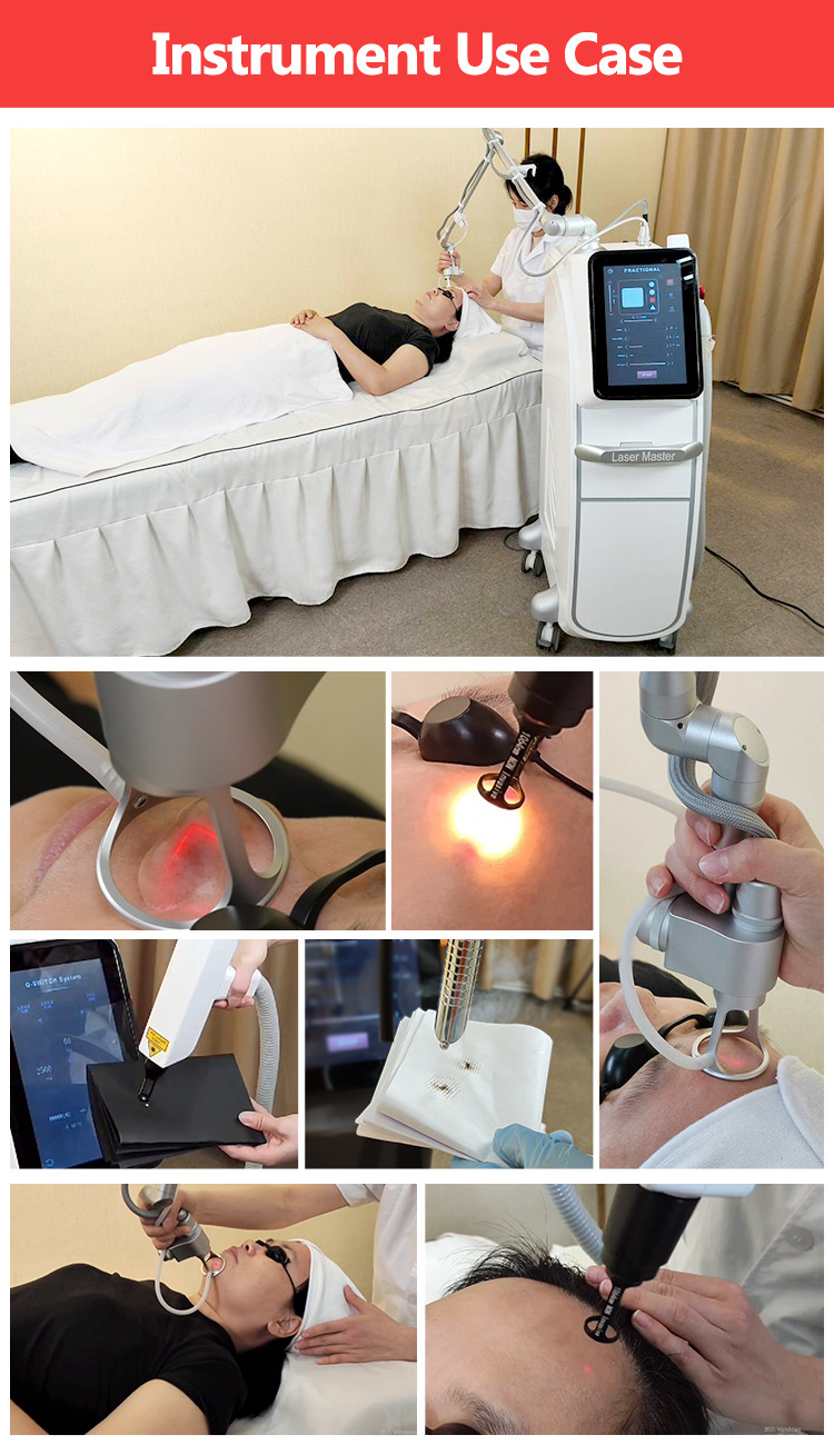 CO2 laser+Q-Switch (2 in 1)